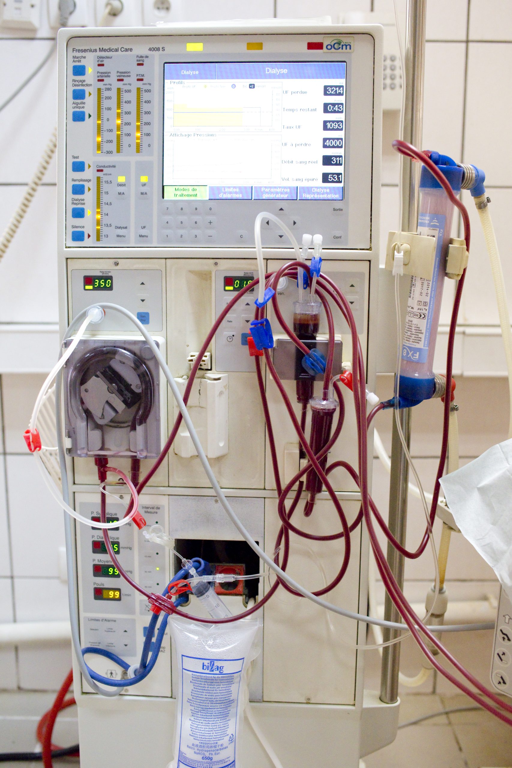 CSU Cameroun: 1ère phase dès 2021