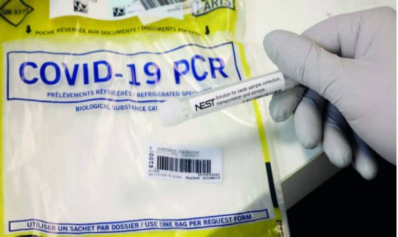 Covid-19: Cost of PCR test reduced from 50,000f to 25,000 Fcfa