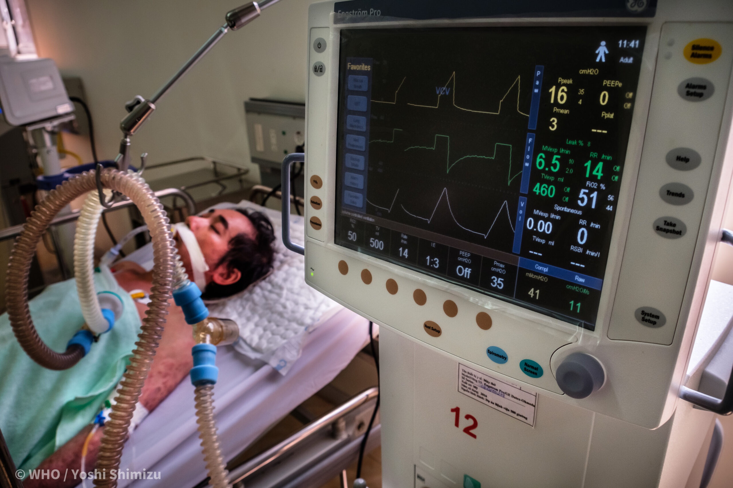 Le ministère de la santé propose d’améliorer la couverture d’assurance pour le cancer et les accidents vasculaires cérébraux