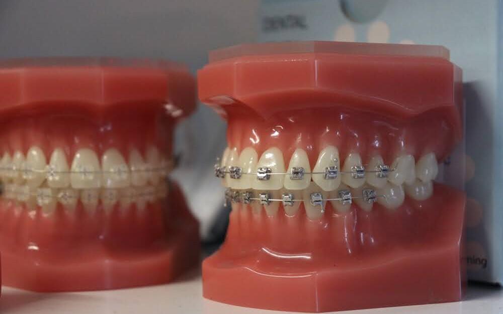 La atención dental para los estonios será más accesible en 2024 con mayores prestaciones y menores franquicias